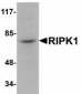 RIPK1 / RIP Antibody (N-Terminus)